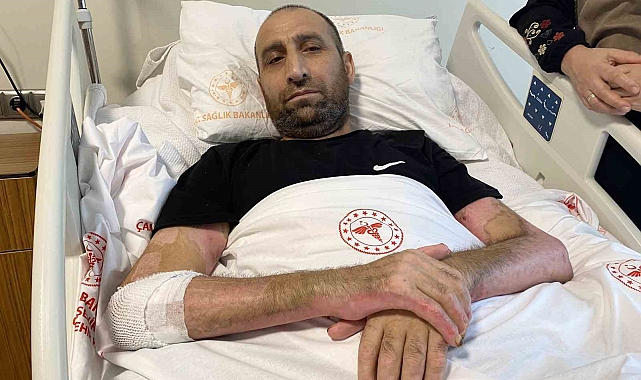 Mangal yapmak isterken 'Tiner faciası': Vücudunun yüzde 80'i yandı, patlamanın şiddeti kameraya yansıdı