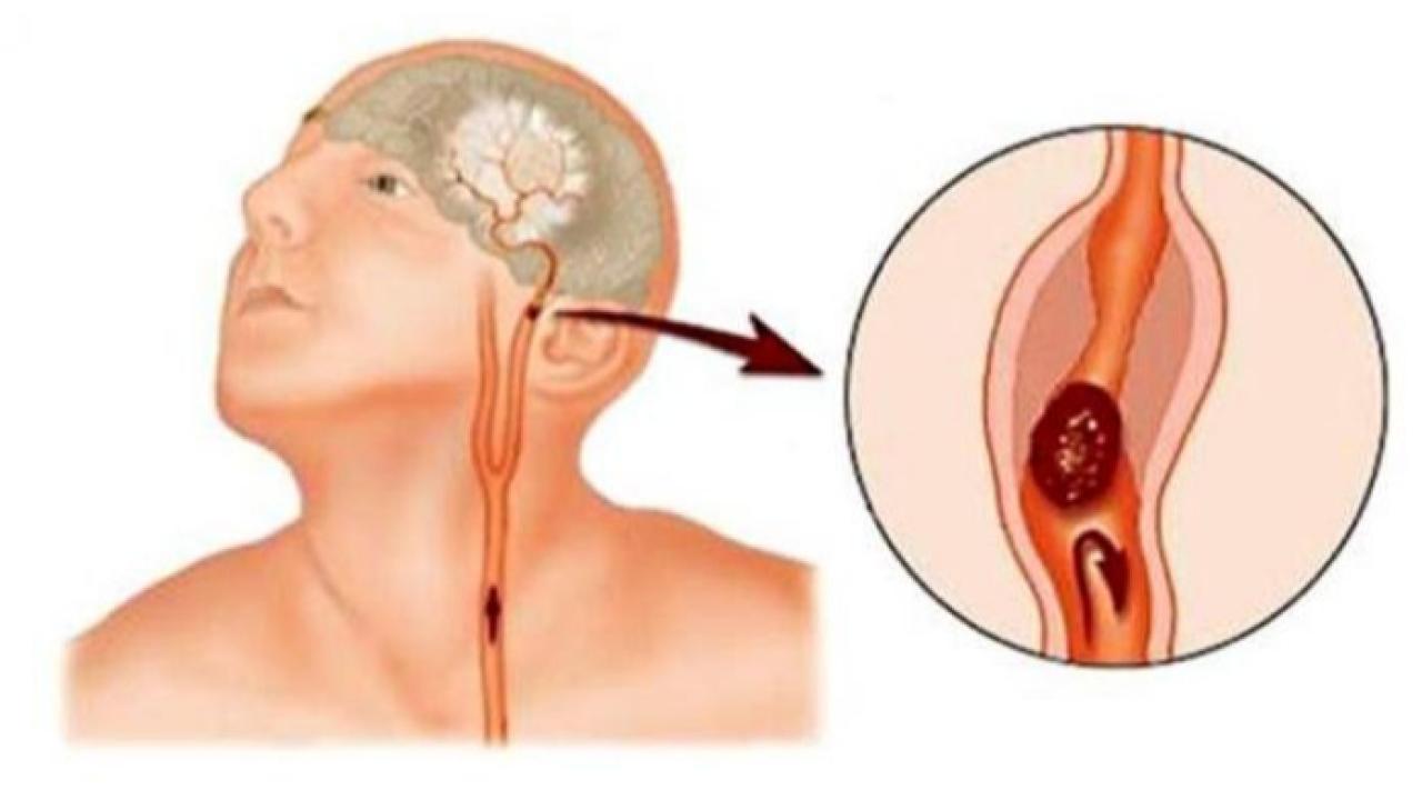 Bayburt İl Sağlık Müdürlüğü’nden hayati uyarı!