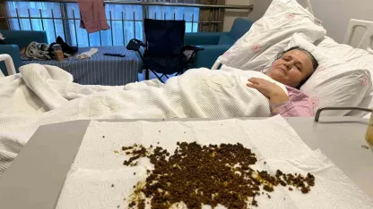 Hastadan çıkan taşları sayamadılar