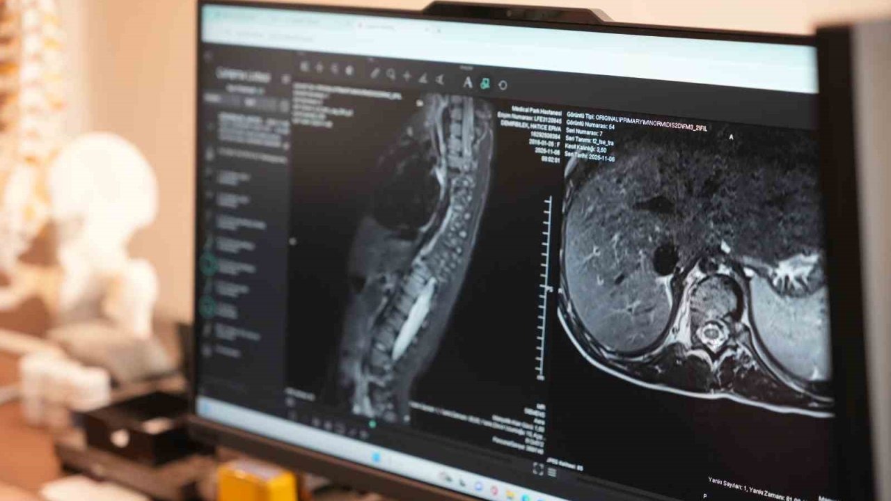 Sinsi ilerleyen bu rahatsızlığı ilk fark eden anneler oluyor