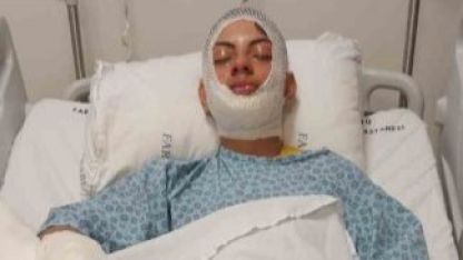 Ateşe benzin döktü, facianın eşiğinden döndü